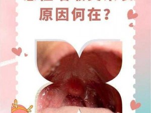 每次跟男朋友口完嗓子都发炎;为什么每次跟男朋友口完嗓子都会发炎？