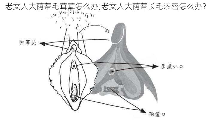 老女人大荫蒂毛茸茸怎么办;老女人大荫蒂长毛浓密怎么办？