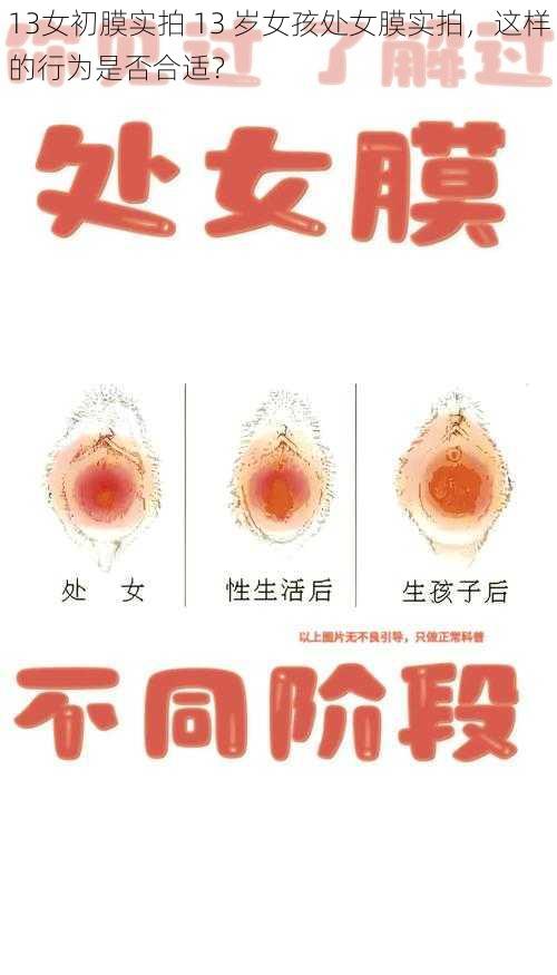 13女初膜实拍 13 岁女孩处女膜实拍，这样的行为是否合适？